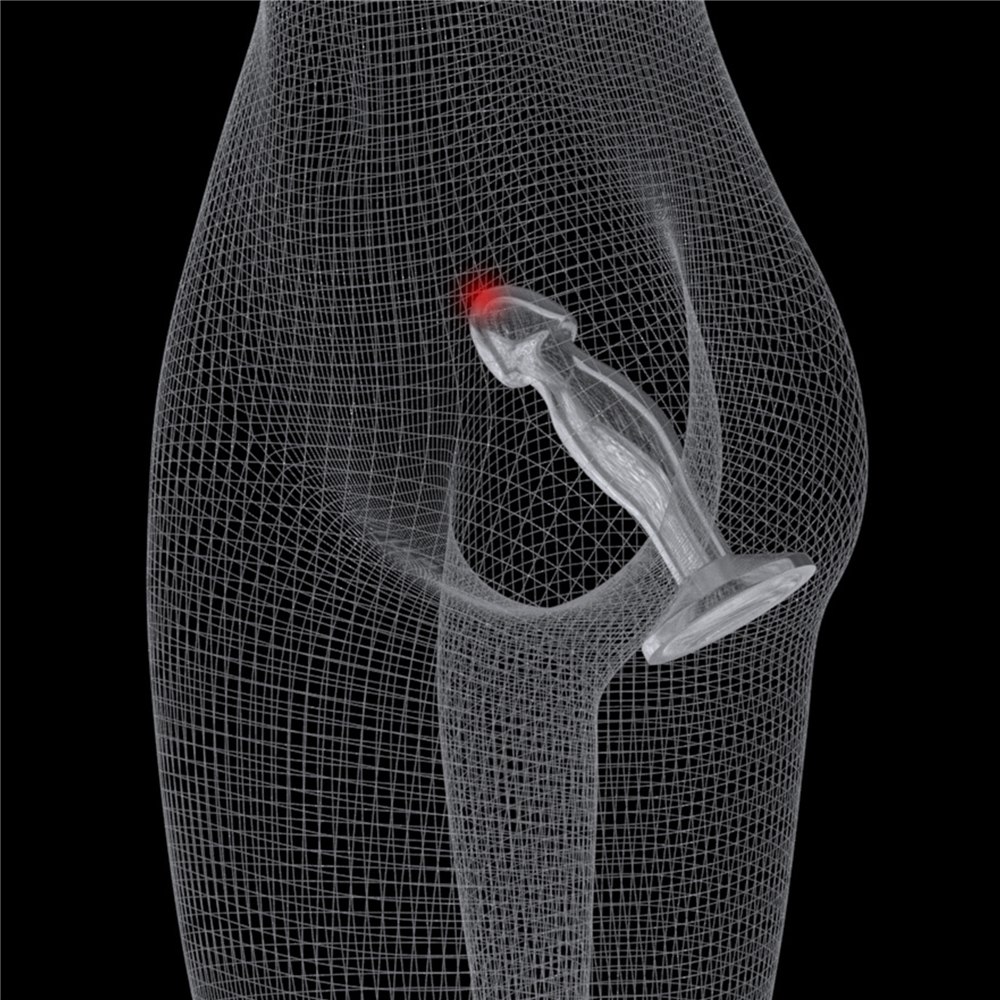 b6fb33661af6bf15947489e0c753fa7e